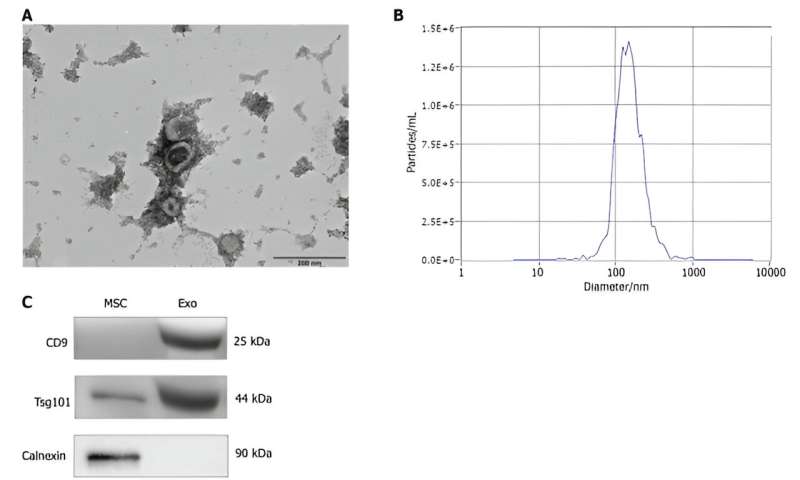 Enhanced wound healing and hemostasis with exosome-loaded gelatin sponges from human umbilical cord mesenchymal stem cells