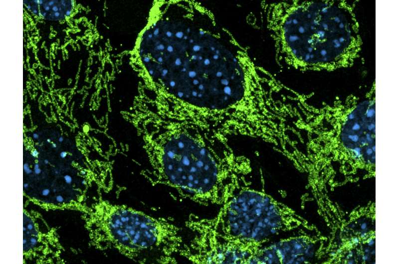 Epigenetic regulator MOF drives mitochondrial metabolism