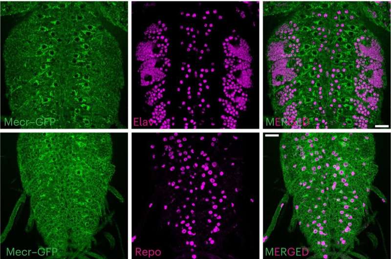Excess ceramide and disrupted iron metabolism in neuronal mitochondria found to be the cause for MEPAN syndrome