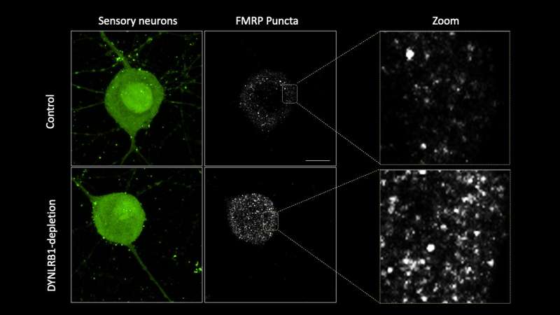 Exploring neurons' molecular highways: how a key protein regulates neuronal health