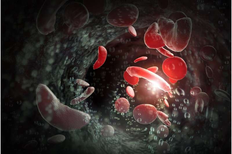 FDA advisors to weigh new gene therapy for sickle cell anemia