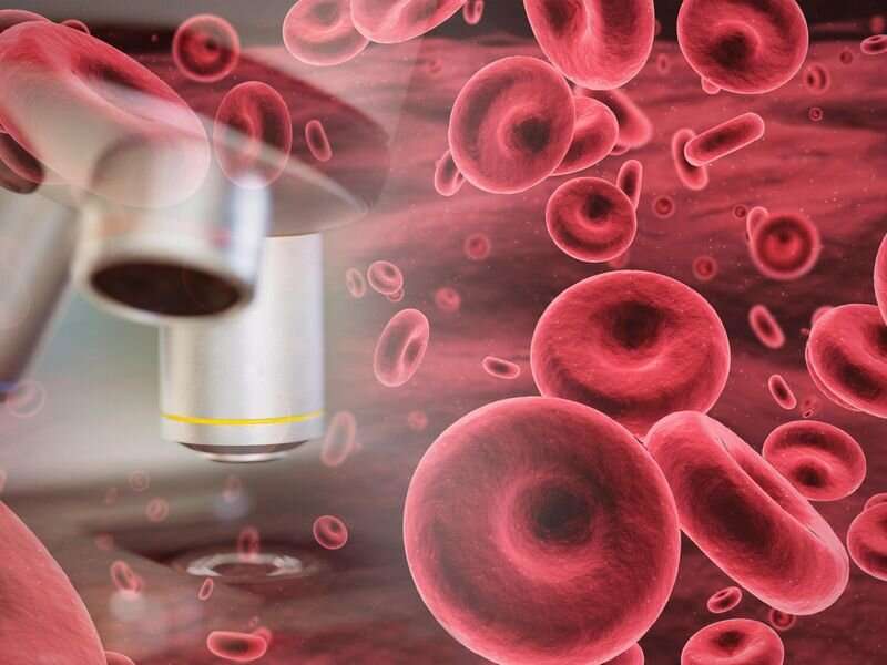 FDA批准脐带血干细胞产品血液癌症患者