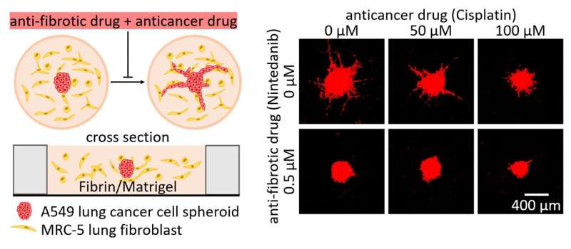 Fibroblast inhibitors assist anti-cancer drugs to suppress cancer growth