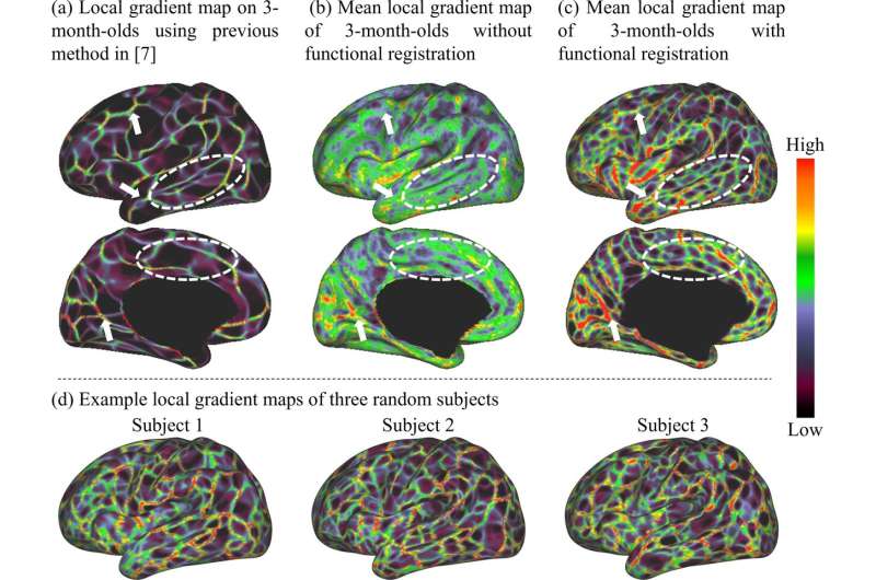 First comprehensive maps of infant brains reveal clues to neurodevelopment