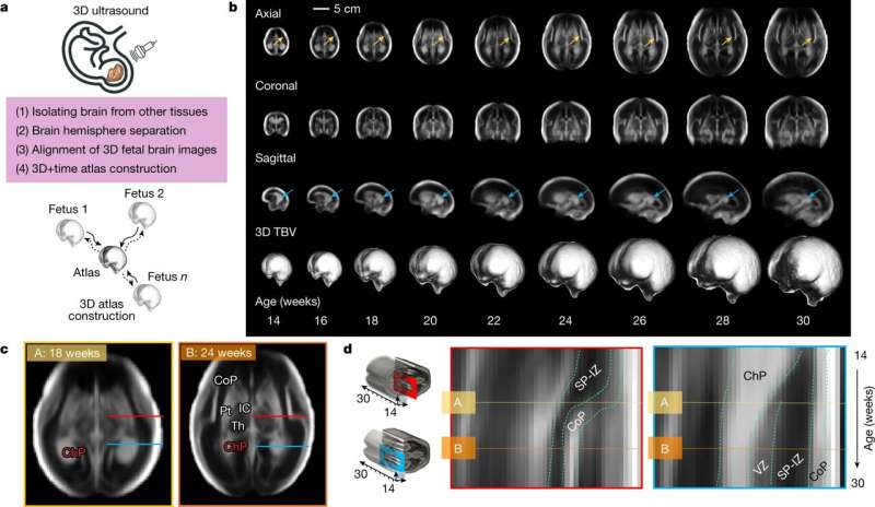 First digital atlas of human fetal brain development published