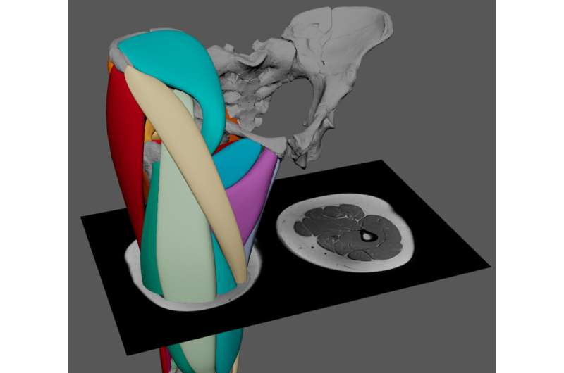 First hominin muscle reconstruction shows 3.2 million-year-old 'Lucy' could stand as erect as we can