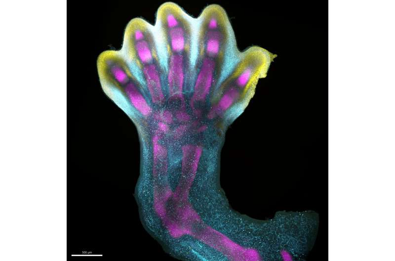 First map of human limb development reveals unexpected growth processes and explains syndromes found at birth