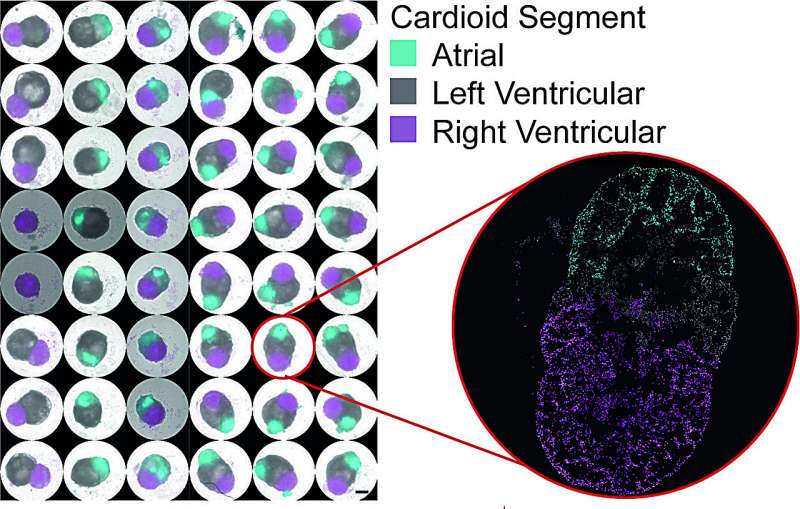 First multi-chamber heart organoids unravel human heart development and disease