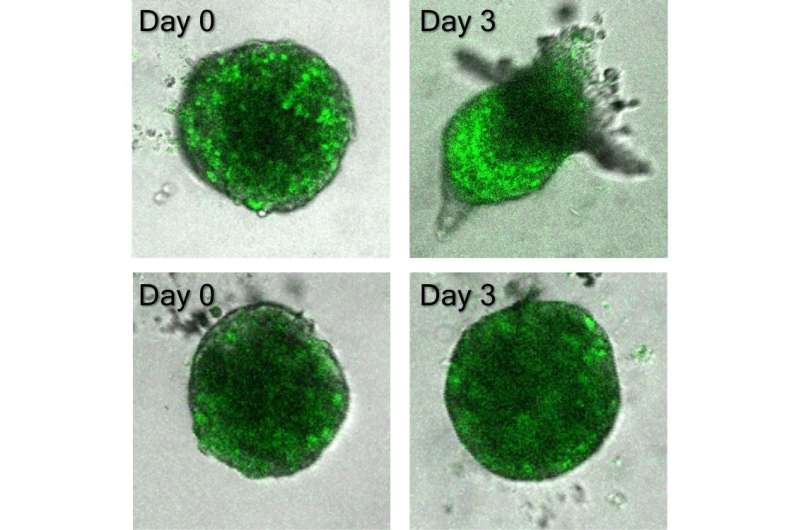 Follow the leader: Researchers identify mechanism of cancer invasion