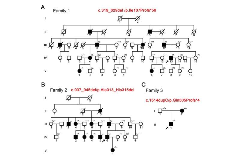 Functional characterization of novel NPRL3 mutations identified in three families with focal epilepsy