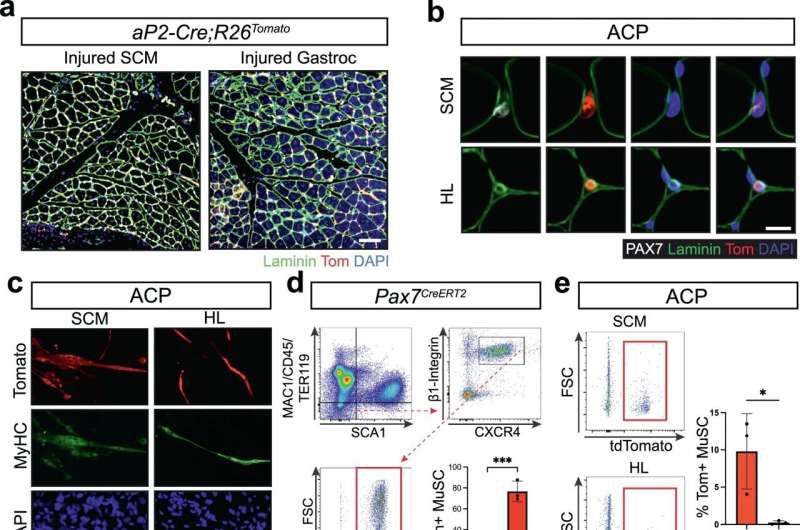 Fusion oncoprotein forces cell fates toward rhabdomyosarcoma