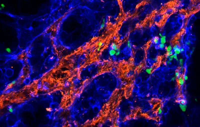 Células T gama delta podem combater o câncer de mama agressivo