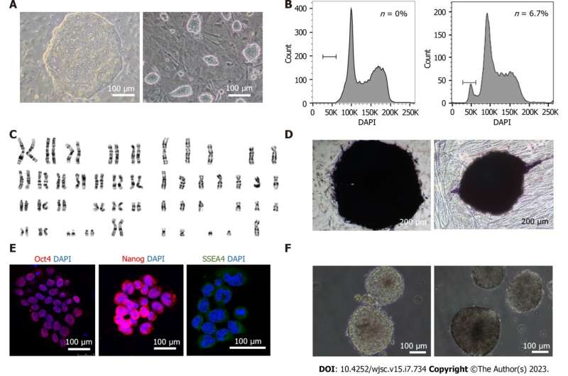 Generation of a human haploid neural stem cell line for genome-wide genetic screening