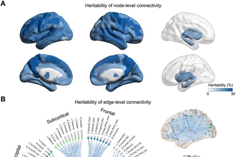 Genetic factors contributing to connection issues for white matter in the human brain discovered