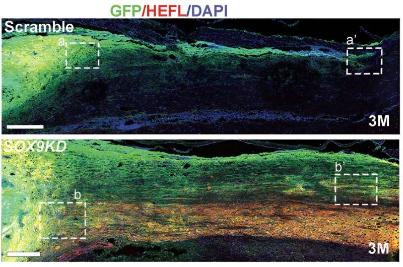 Genetically modified neural stem cells show promising therapeutic potential for spinal