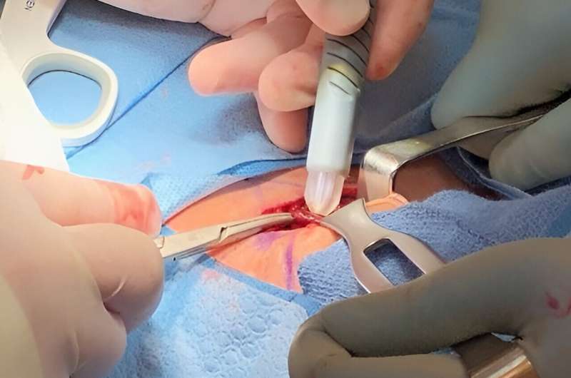 Handheld probe offers power of real-time tissue identification during surgery