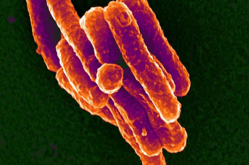 Harnessing power of immune system may lessen reliance on antibiotics for infections like TB
