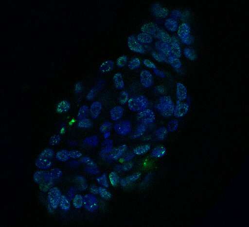 Head and neck cancer organoids as a step towards personalized treatments
