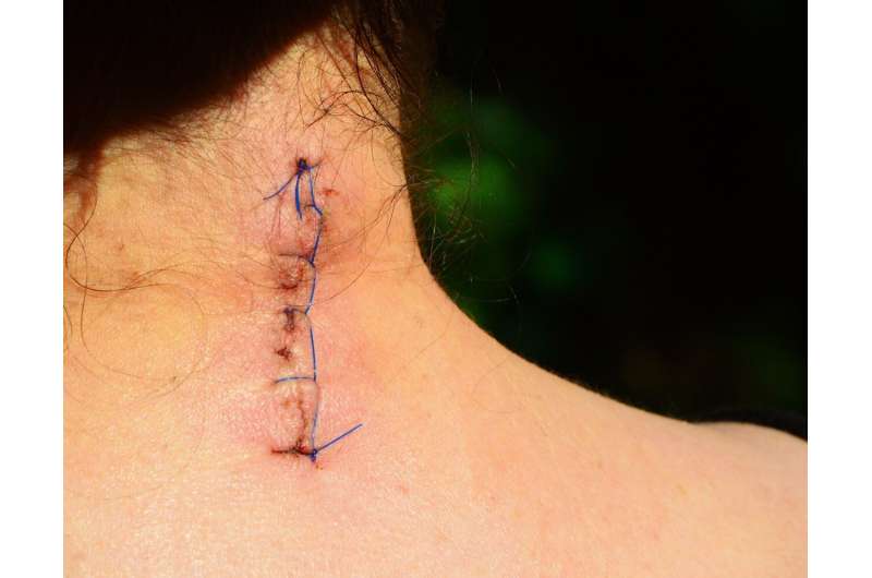 healed scar