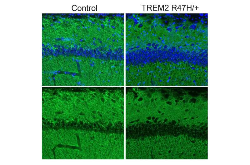 How a mutation in microglia elevates Alzheimer's risk