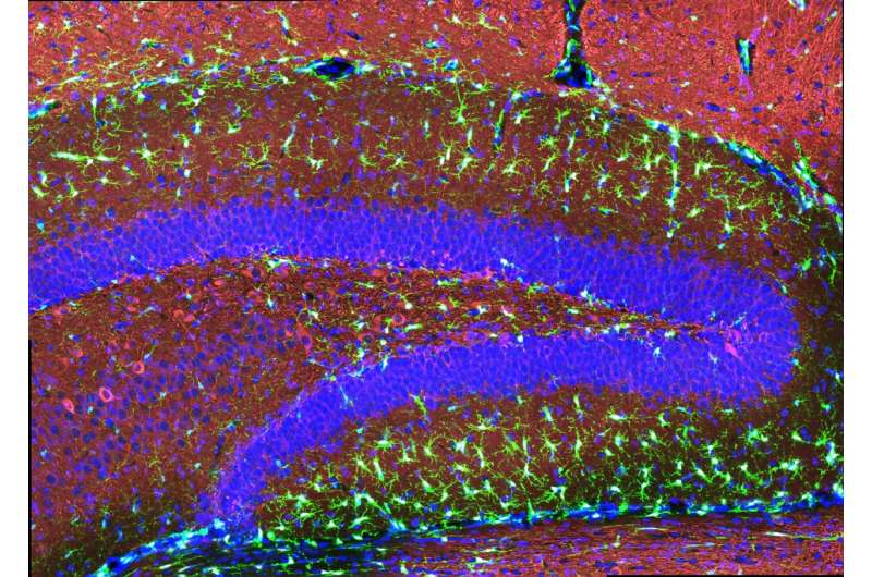 How a mutation in microglia elevates Alzheimer's risk