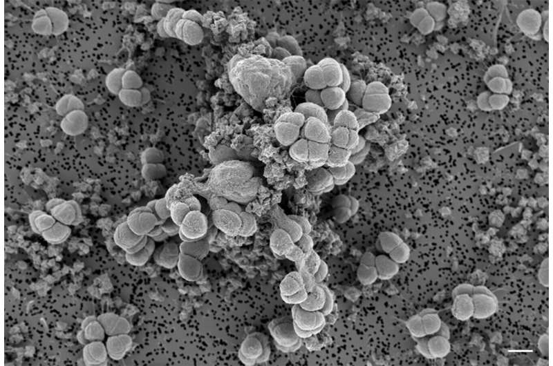 How ancient microbes extract important metals from their environment