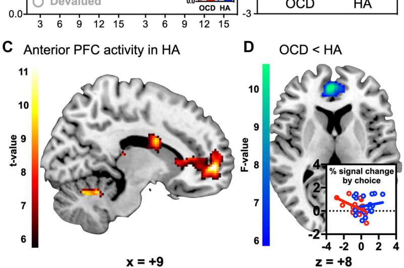 How decision-making mechanisms go awry in OCD brains