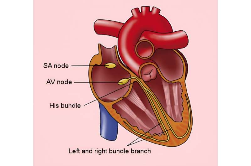 How do pacemakers and defibrillators work? A cardiologist explains how they interact with the electrical system of the heart