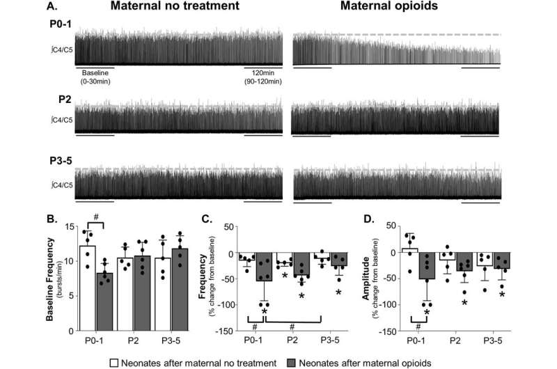 How prenatal opioid exposure impairs breathing in newborns