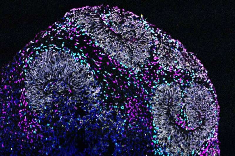 How proteins interact may hold key to future autism treatments