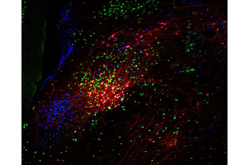 How the brain detects and regulates inflammation