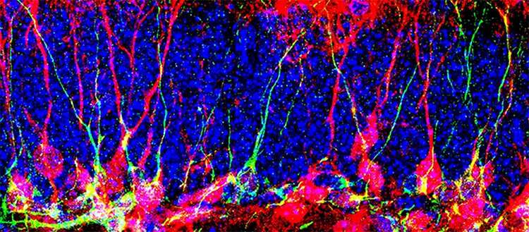 How to generate new neurons in the brain