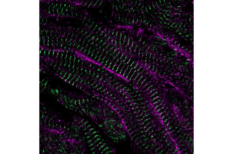 How to repair a damaged heart: Key mechanism behind heart regeneration in zebrafish revealed