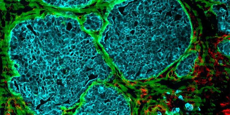 How tumours transform blood vessels