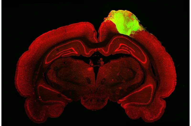 Human brain organoids respond to visual stimuli when transplanted into adult rats