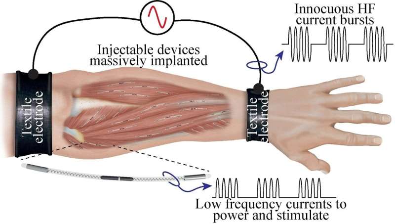 Human-machine interface stops muscle tremors