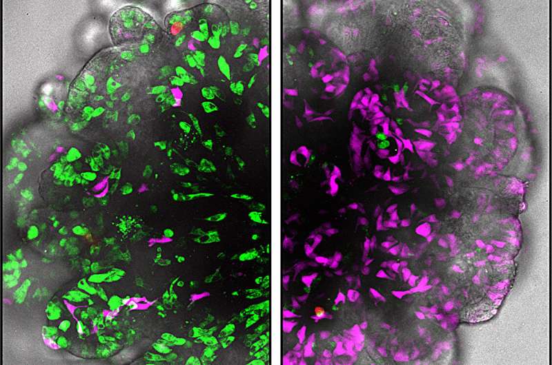 Human organoid research identifies crucial 'traffic light' in gut cell differentiation