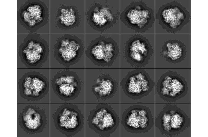 Images of enzyme in action reveal secrets of antibiotic-resistant bacteria
