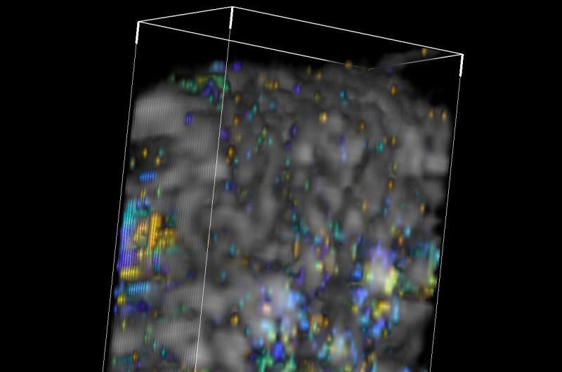 Imaging advance poised to provide new insights into reproduction and infertility