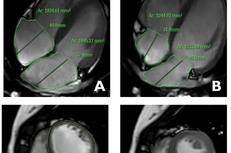 Imaging the adolescent heart