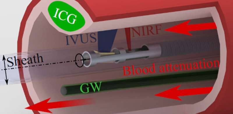 Improving the accuracy of near-infrared fluorescence in cardiovascular imaging