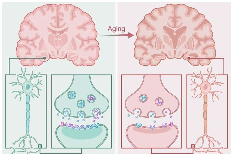In-depth review reveals dietary lipid intervention as potential strategy to prevent brain aging
