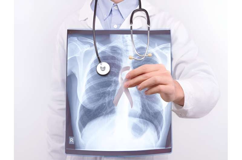 Incidence of lung cancer higher in women versus men aged 35 to 54 years