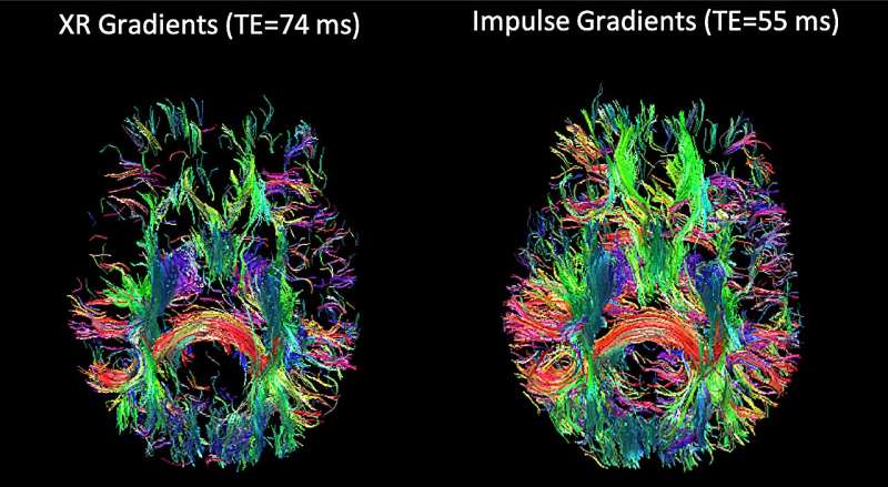 Innovative design achieves tenfold better resolution for functional MRI brain imaging