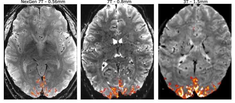 Innovative design achieves tenfold better resolution for functional MRI brain imaging