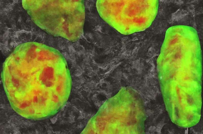 Investigating the link between iron deficiency and regulation of cell growth