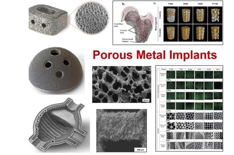 Investigating the porous metals in orthopedic implants and beyond