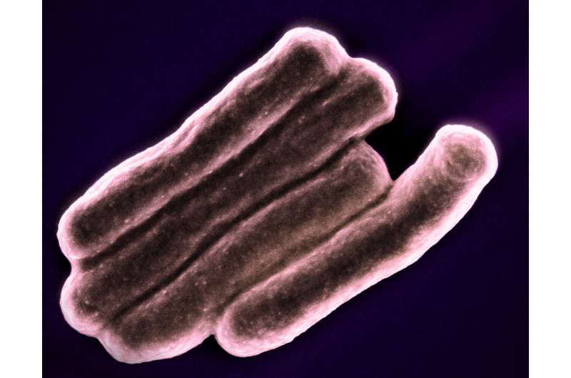 Investigational three-month TB regimen is safe but ineffective, NIH study finds
