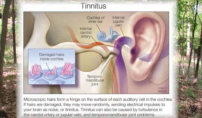 Is tinnitus causing that ringing in your ear?