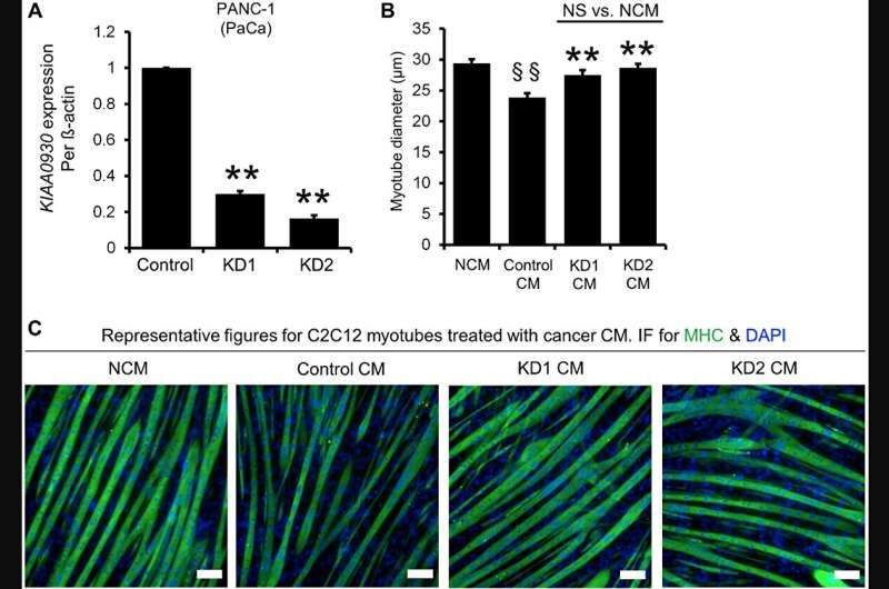 KIAA0930: A cachexic phenotype inducer in cancer cells
